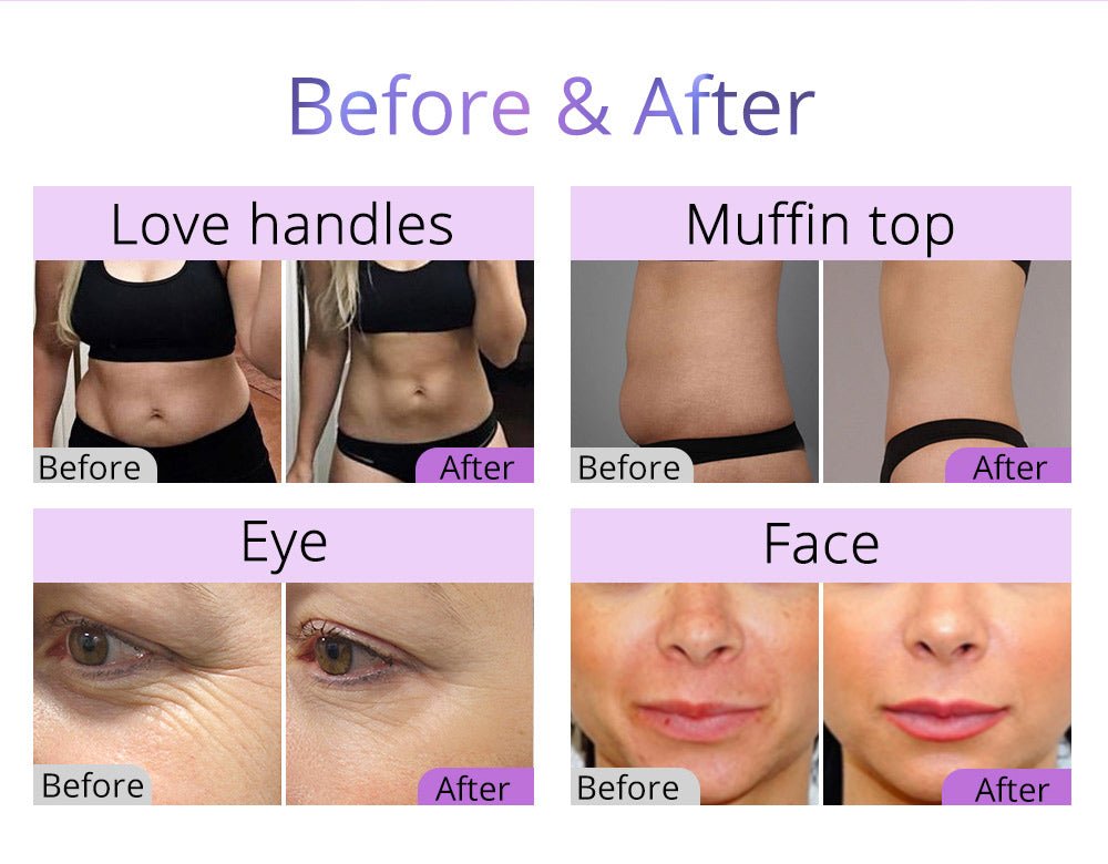 Shape Tactics 5-in-1 80K Cavitation Vacuum Therapy System