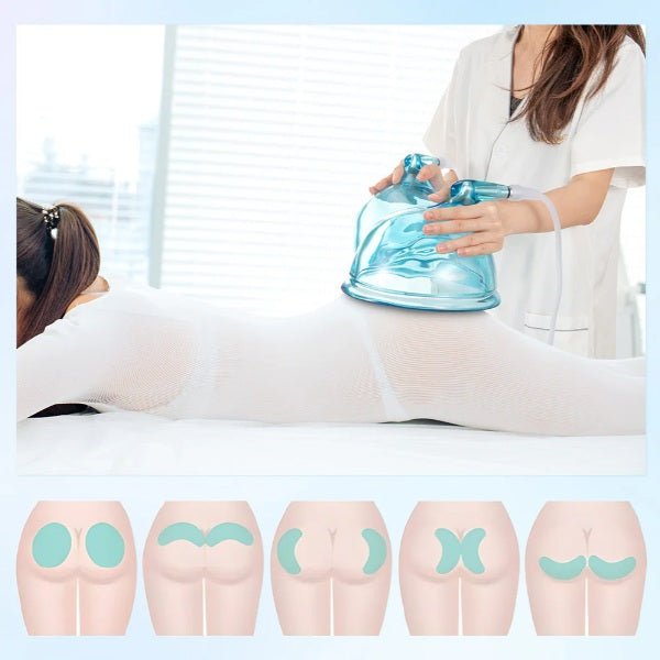 Shape Tactics 18.5cm Vacuum BBL Suction Therapy Cups