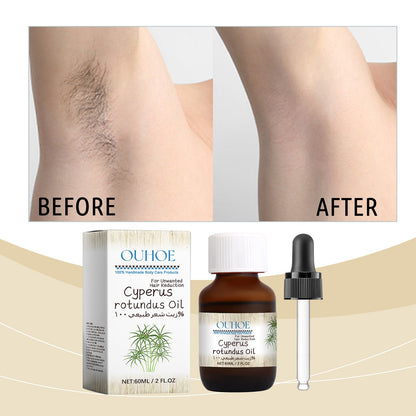 Cyperus Hair Removal Care Oil