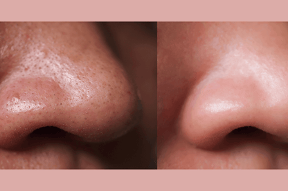 Ultra-Advanced Anti-Aging Daily Resurfacing Pads