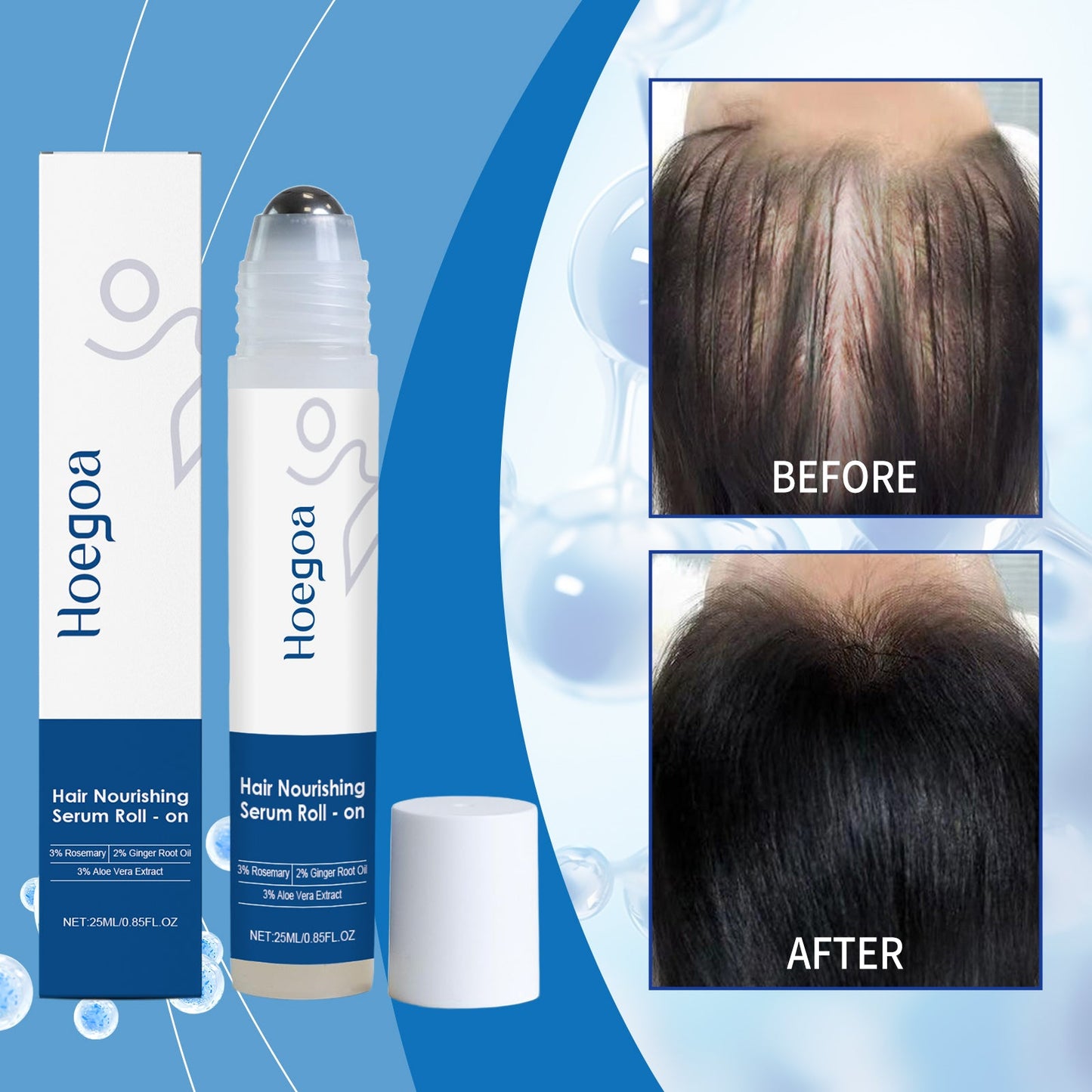 Hair Growth Roll-On