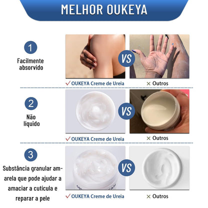Urea Cream Moisturizing Hand And Foot Cream For Dryness Prevention