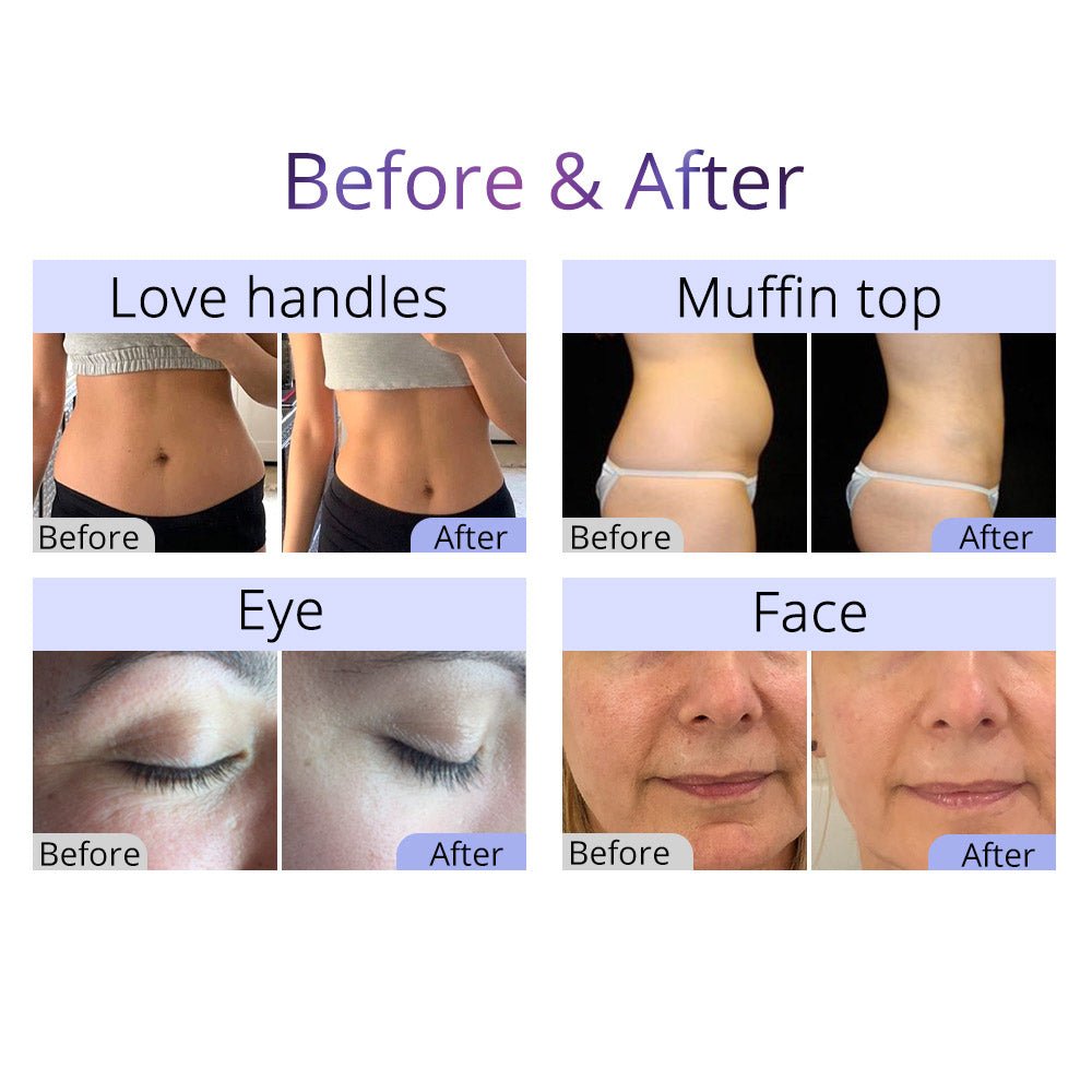 Aristorm 40K Cavitation 2.5 RF Skin Scrubber & Facial System