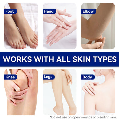 ETEB Urea Cream Moisturizing Vitamin E Cream Body Lotion Hand And Foot Care For Dry Hands And Feet
