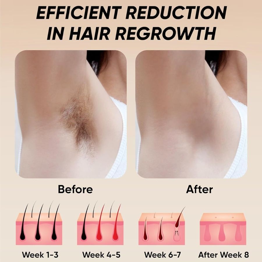 IPL Laser Hair Removal Device - 900,000 Flashes for Smooth Skin on Legs, Arms, and Bikini Line