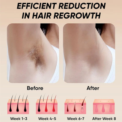IPL Laser Hair Removal Device - 900,000 Flashes for Smooth Skin on Legs, Arms, and Bikini Line