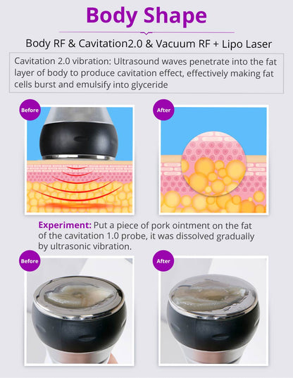Kim 10 6-in-1 Cavitation RF Lipo Laser System