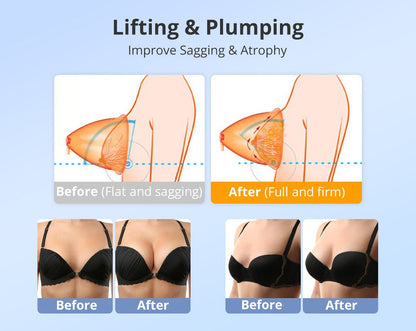 Shape Tactics 40K Cavitation and RF Vacuum Contouring System
