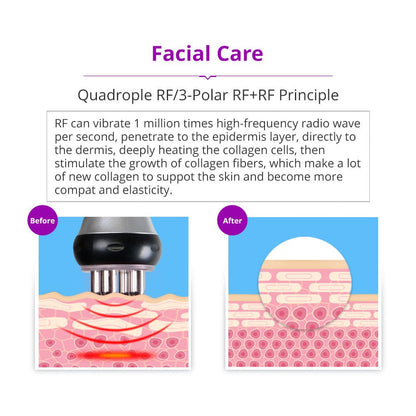 Shape Tactics 5-in-1 Cavitation RF Vacuum Body Contouring System