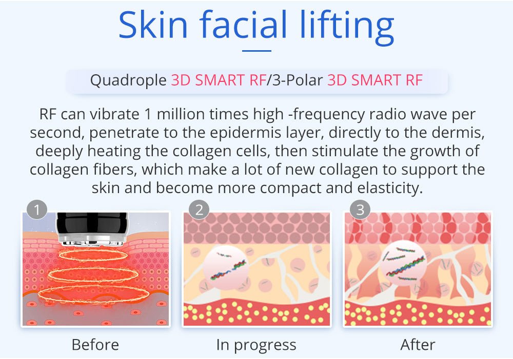 Shape Tactics 6-in-1 Unoisetion Cavitation 2.0 Vacuum RF System