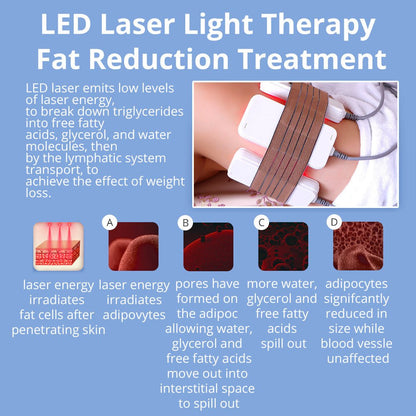 Shape Tactics 6-in-1 Cavitation RF Cryolipolysis Lipo Laser System