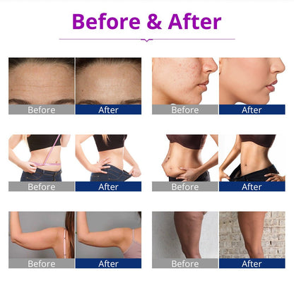 Shape Tactics 6-in-1 Cavitation RF LED Laser Lipo System