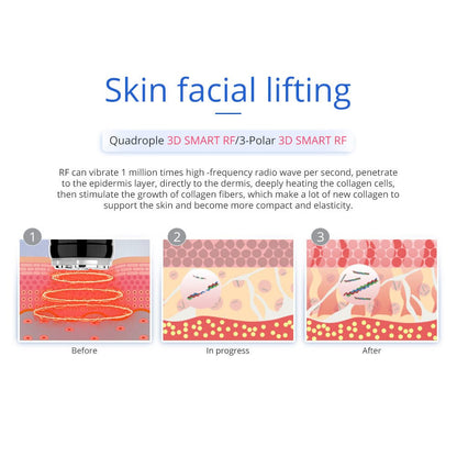 Shape Tactics 7-in-1 40K Ultrasonic Cavitation & RF Hot-Cold Therapy System