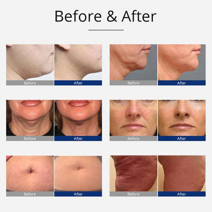 Shape Tactics 8-in-1 Cavitation RF Bio Hot and Cold Therapy System