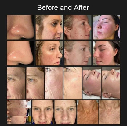 Shape Tactics 8-in-1 Hot & Cold Fusion Plasma Facial Beauty System