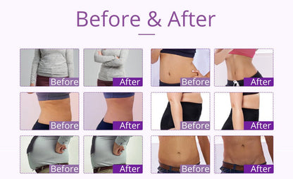 Shape Tactics 9-in-1 Lipo Microcurrent Photon Ultrasonic Cavitation System