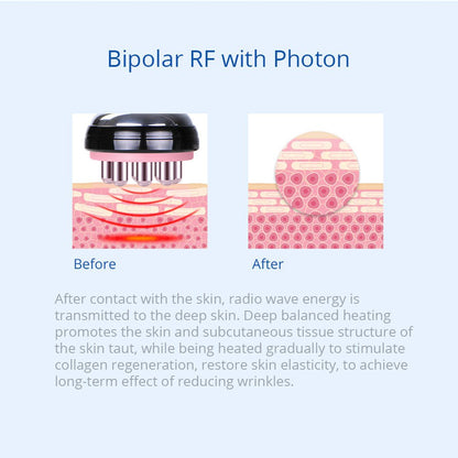 Shape Tactics Advanced 5-in-1 Cryolipolysis 40K Cavitation RF Lipo Laser System