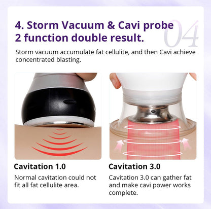 Shape Tactics Cavstorm 40K Cavitation 3.0 with Microcurrent RF System