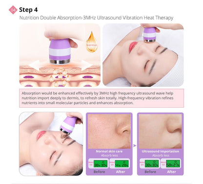 Shape Tactics Diamond Dermabrasion & Ultrasonic Skin Care System