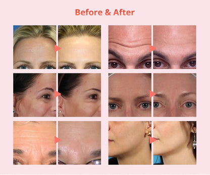 Shape Tactics Diamond Dermabrasion & Ultrasonic Skin Care System