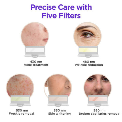 Shape Tactics IPL Hair Removal and Skin Rejuvenation System