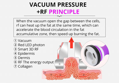 Shape Tactics 5-in-1 Ultrasonic Cavitation Vacuum RF Beauty System