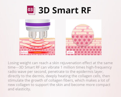Shape Tactics 6-in-1 Cavitation Lipo Laser Photon RF System