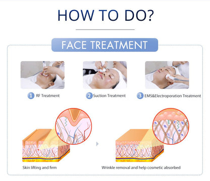 Shape Tactics S-Shape Pro 30K Cavitation RF Contouring System