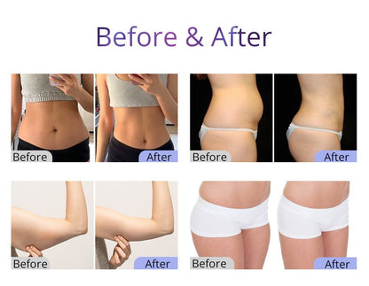 Shape Tactics UltraShape 2.5 Cavitation System
