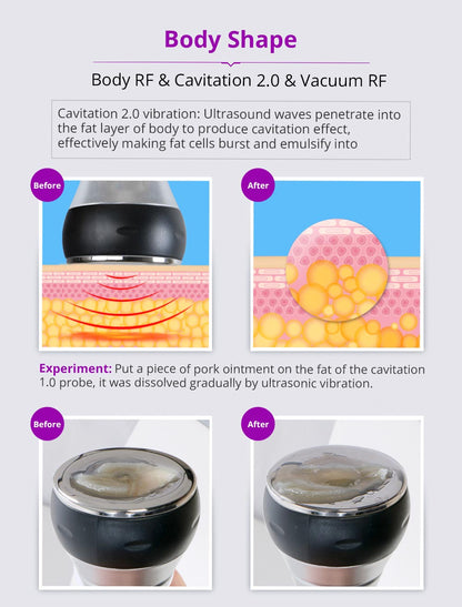 Shape Tactics Unoisetion 40K Cavitation Ultrasound RF Vacuum Photon System